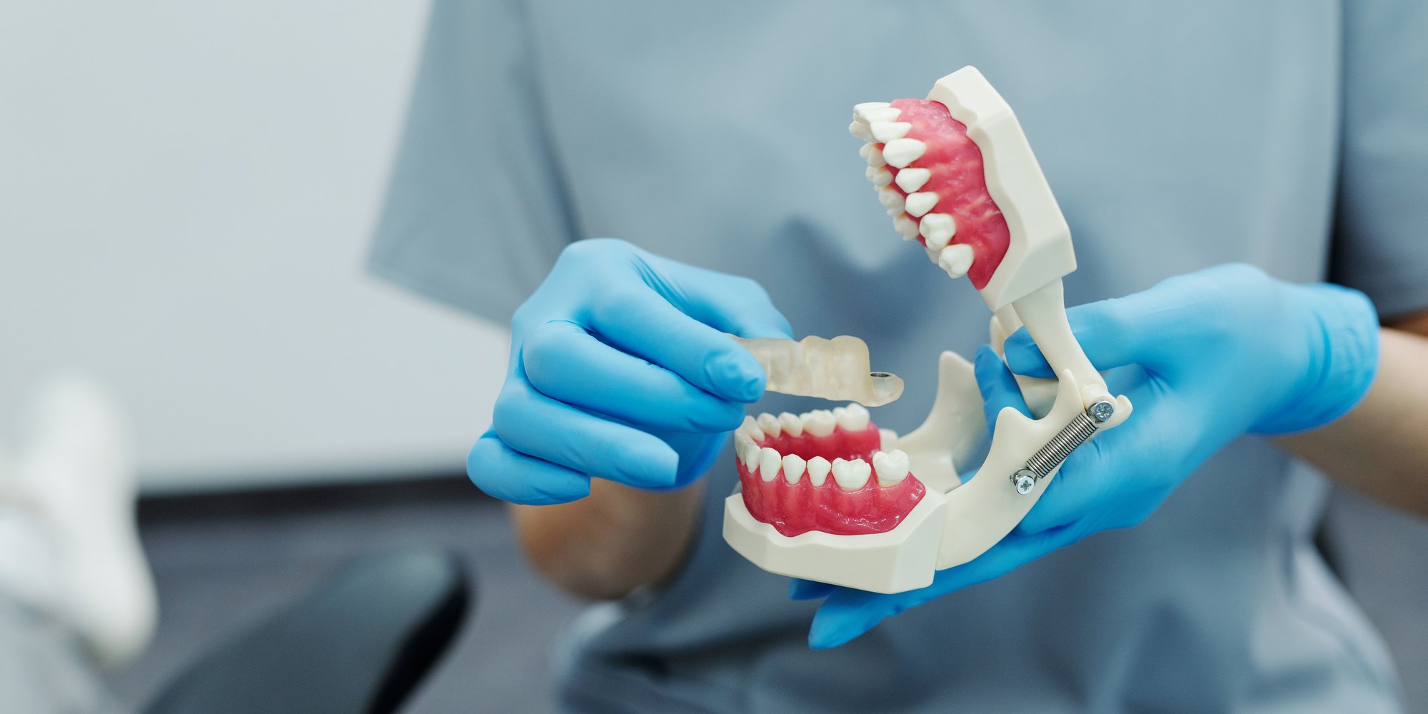 Протезирование зубов в клинике Estet Dent